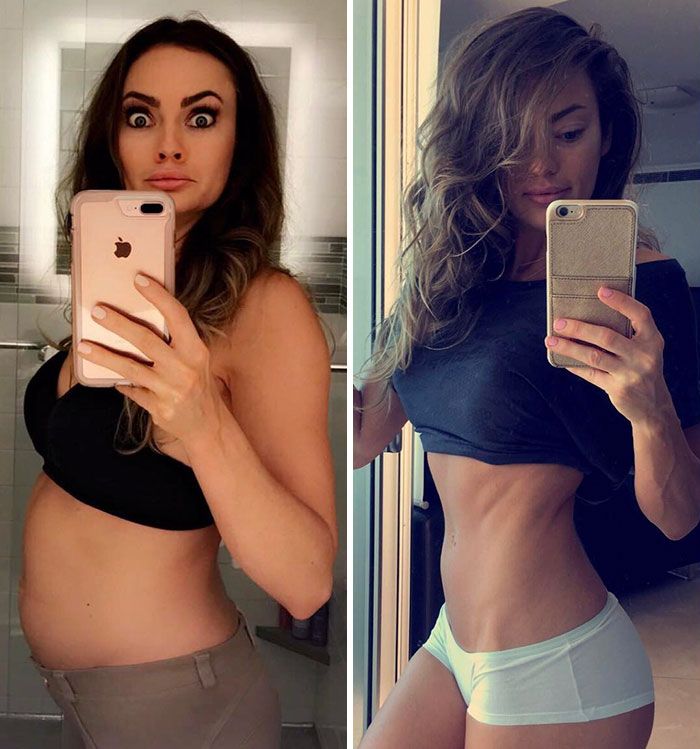 Before And After Photos Of “weight Loss” Reveal The Biggest Lie Behind Them