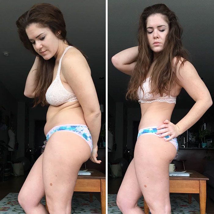 Before And After Photos Of “weight Loss” Reveal The Biggest Lie Behind Them