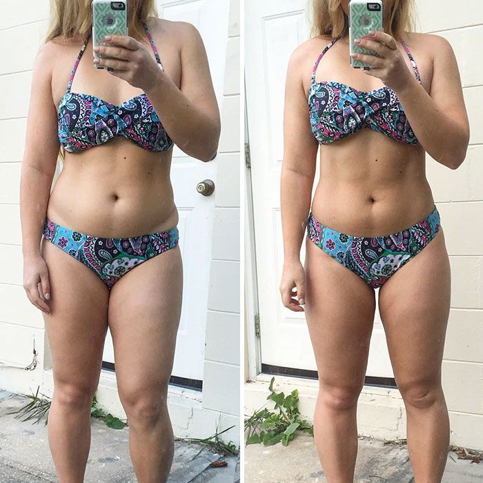 Before And After Photos Of “weight Loss” Reveal The Biggest Lie Behind Them