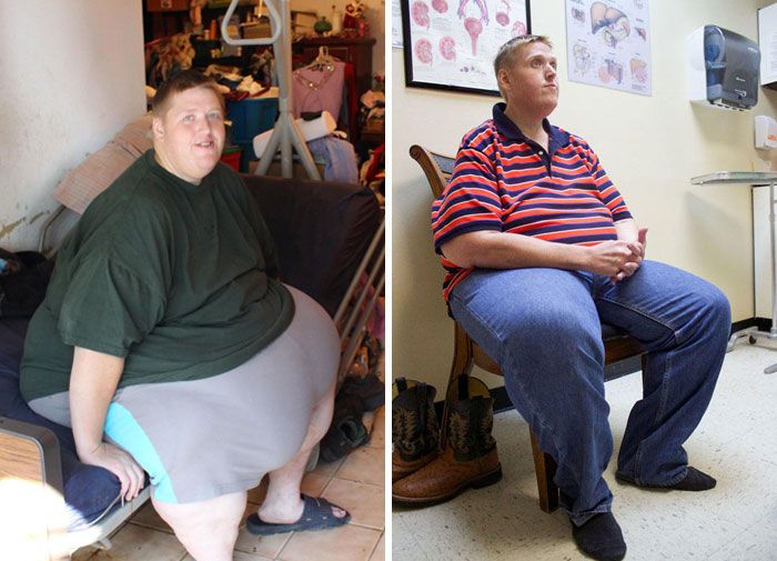 The most incredible weight loss transformations of all time.