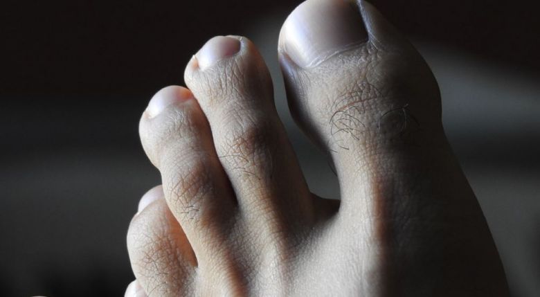 Pins And Needles In Hands And Feet Causes Symptoms And Treatment