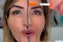Botox Exposed: Doctor Treats Only Half Her Face - The Results Will Surprise You