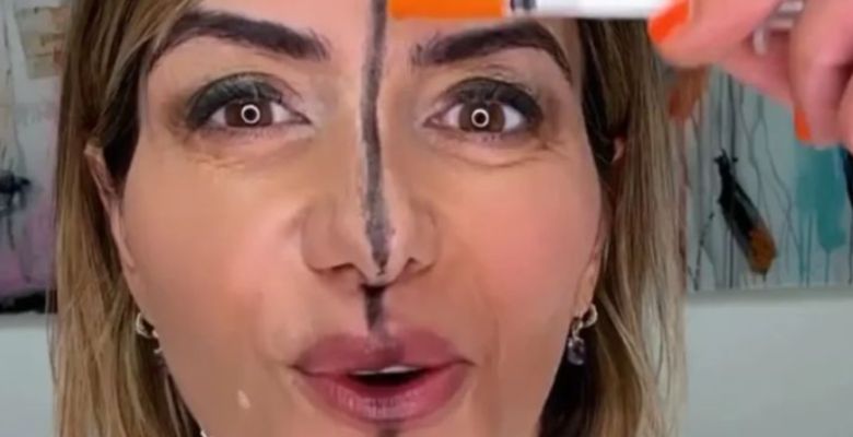 Botox Exposed: Doctor Treats Only Half Her Face - The Results Will Surprise You
