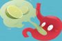 Everyday Habits You Didn't Know Cause Heartburn