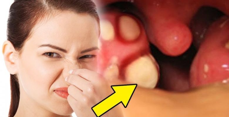 Foods That Influence Body Odor: A Comprehensive Guide to Dietary Effects on Your Scent