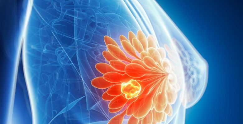New Frontiers in Cancer Treatment: Mounjaro's Potential Beyond Weight Loss