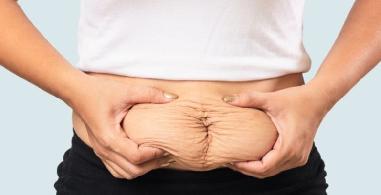 Your Guide to Tighter Skin: Non-Surgical Solutions After Weight Loss