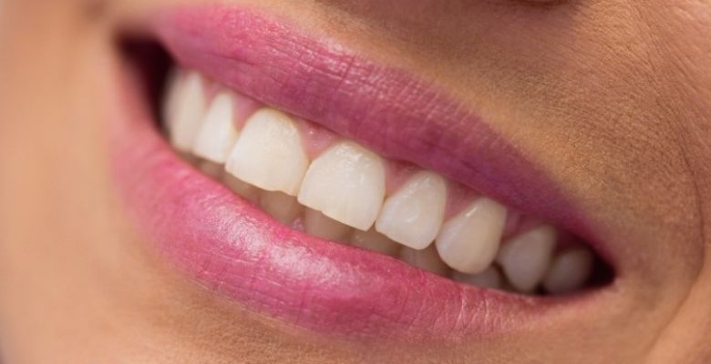 The Silent Saboteurs: Twelve Foods to Avoid for Optimal Dental Health